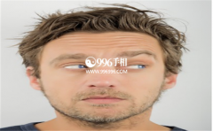 �����۾�б���ˣ�������������ҽ���һ��Ҫ����