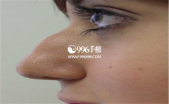 Ů��ӥ�������࣬����������������ǲ��Ƕ�һ������