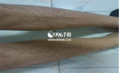 Ů����ë������Ů�Ե���ë���ൽ�׺ò���