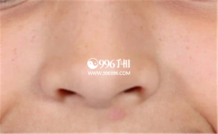 <b>��ë�ϳ������˴�����彡��״������</b>