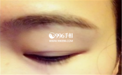 ����Ƥ���������������������˲�������Ϊ��������Щ����