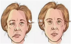 �����������������Լ��������沿�������Ľ�Ϸ���