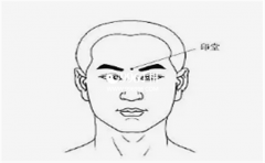 ӡ������ͼ�⣬ӡ�÷��ڣ����д��ѽ���