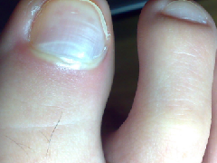 ��������ȫ�д�һ���˵Ľſ�����