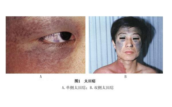 �������ж�һ�����Ƿ񽡿�