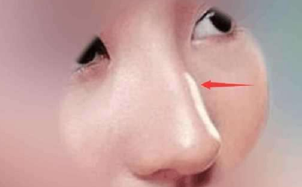 ���˿�����Ů����������ȫ��ʲô����������?