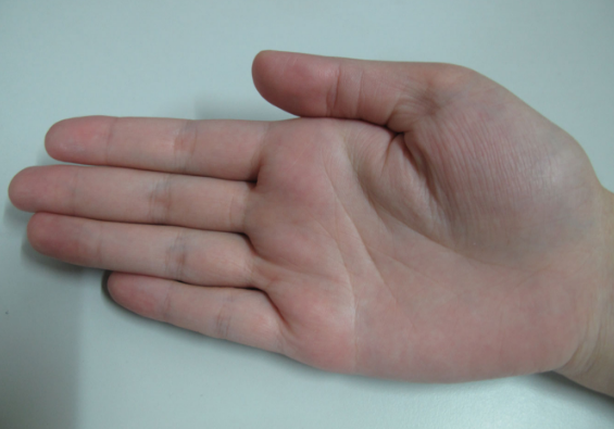 ���������������ߣ����ٵ��˶�����Щ�ص㣿