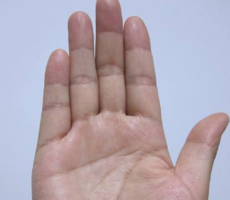 �����ָͷ�����Դ���ʲô