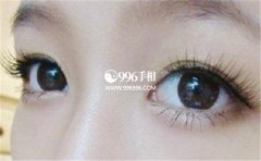 ��������������Щ�۾����˲���û��׷���һ��˺�