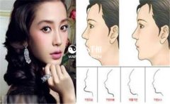 ���������Ƶ����࣬�����кñ�