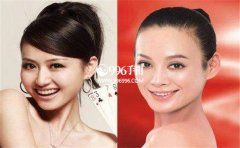 ���໨�������̵㣬���ٵ��˶�����������