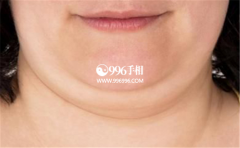 ˫�°����������������һ��֮�ж����и���