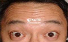 �ж�ͷ�����࣬���ֶ�ͷ�Ƶ��������