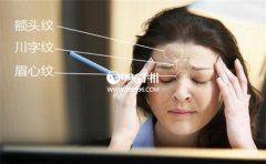 ��ͷ�����࣬���ֶ�ͷ�Ƶ��������