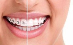 ���������������Ը񣬴�ҿ��ԶԱ�һ��׼��׼