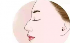 ������ӿ�����û�и�����