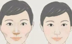 ��ٷ��� �����Ǹ�ʲô������ 