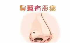 ������ĺû�����֪��������� ����һ�¿�����û�� 