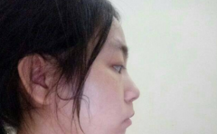 ������ٵķ��� ������Щ���͵Ĳ�� 