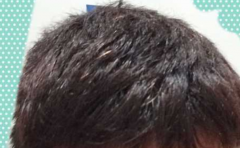 ��ͷ�������� ��һ�������ƺû� 