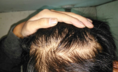 ͷ��ϡ����˽��� ͷ���������������� 