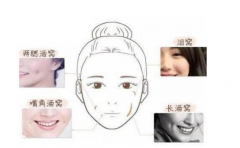 ���������һ����� ���϶�����Щ�ص� ������û�� 