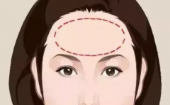 ӵ���⼸�ֶ�ͷ���� ע���������� �Ҳ�ҵ�� 