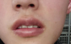 �����촽��������ÿ� �����ܰ�������� �޸��������Ҹ� 