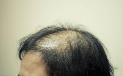 ͷ��ϡ����˾�Ȼ�к����� ���˲���˼�� 