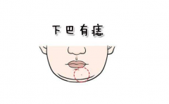 ������������˵��������ط� �����ض���ƶ�� �������� 