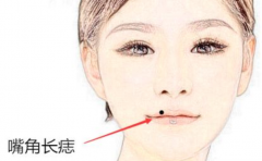 �촽����ͼ�� ������ߵ����к�Ҳ�л� ������һ��������Ľ 