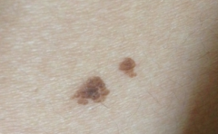 �����ɫ����û���ǳ�� ��״λ�õĲ�ͬ���п��ܻ�ı�������� 