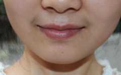 �촽����ë���˻���ʲô�������� ���ų�����ȴ�ܺ� 