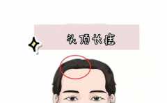 ͷ��������ʲô��˼ û�뵽�������˲����и�֮�� 