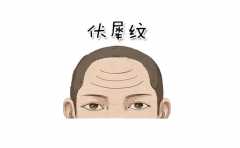 ��ͷ��·��ȫͼ�� ��Ķ�ͷ��ʲô��· ����Ԥʾ����ʲô�� 