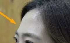 �۲췢�� �������ϰ���� ����ƽ������ 