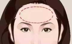 ����Ե���� ͨ���Ƕ�ͷ���� ����ʺ� 