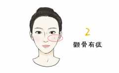 <b>Ů���沿������� ��Щ�沿����Ԣ����в�ͬ ������ </b>