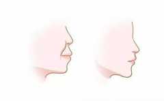 ʲô�������˲�ֵ�ü� �����ӷ��� ��һ����һ�� 