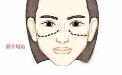 üë��������� �������²���Ƣ���� ��������û���� 