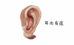 ��Ǯ�����೤ʲô�� ��һ��ȫ�Ҹ� ������ȫ�帻 