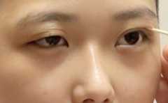 �����۵��� ˫Ŀ���� ���������� ���Ҳ����� 