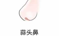 ��������ͷ�ǵ��� ���˲��� ��©�� 