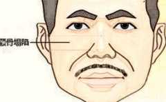 ����4��������� �޸��� ��ֻ�ܳԿ����� 