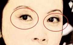 ��С��������� �����۾������Ը��� 