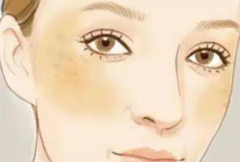 �̱�������©���� ���˲�֪��ԭ������������˶಻��